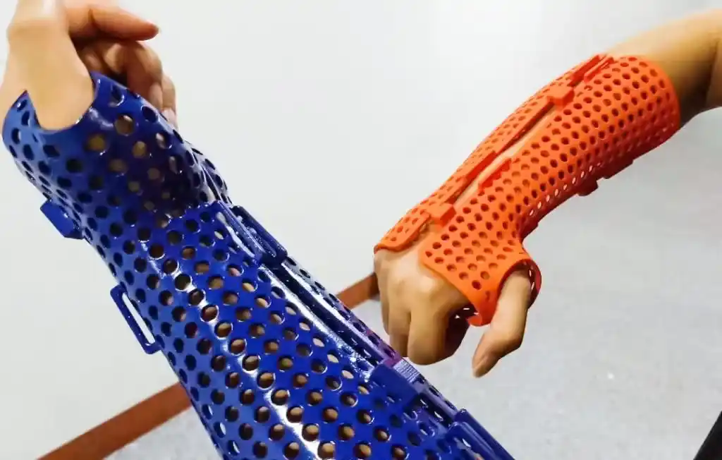 3D Printed Elbow Wrist Hand Orthosis