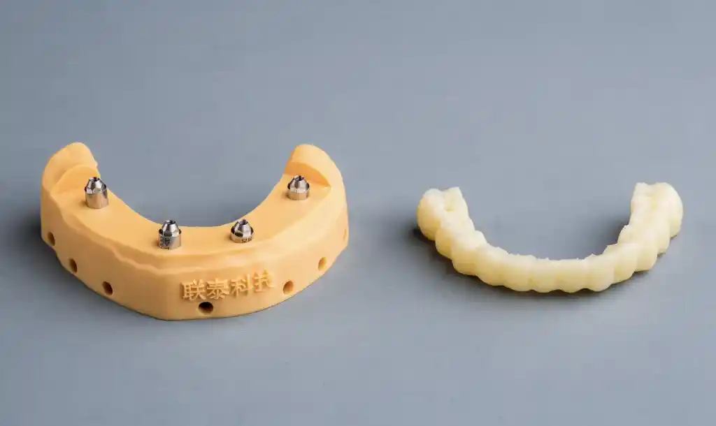 3D Printed Implant-Supported Prosthetics