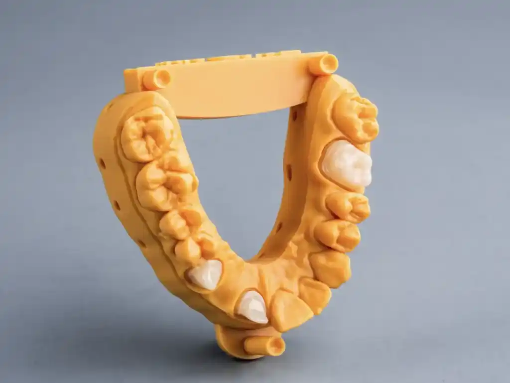 3D Printed Dental Model
