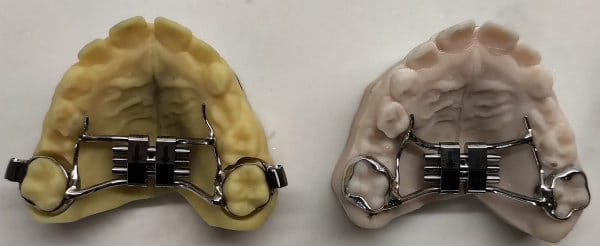 3D printing Orthodontics