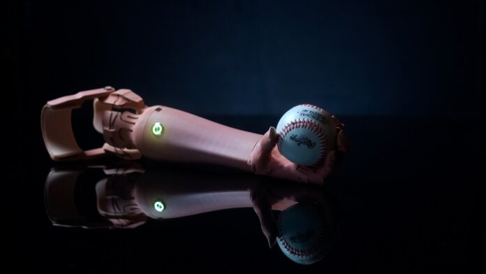 3D printing custom prosthetics